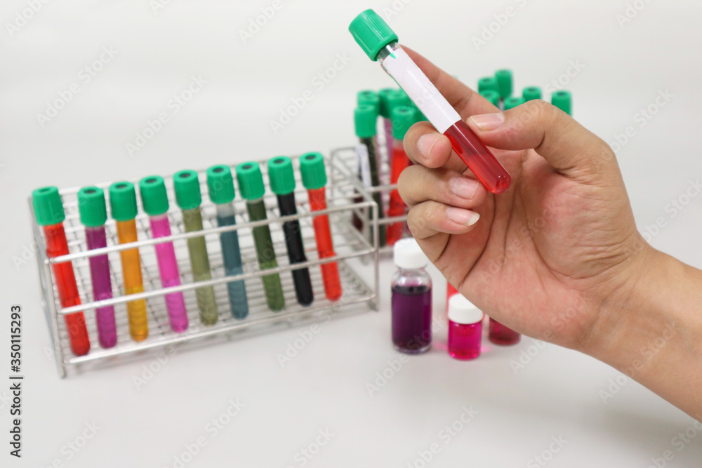 Cell-culture tube with red blood solvent or solution handle in hands without wearing gloves, with colorful culture cell tubes cover with green caps, PPE is required for analysis experiment Anti-virus. Cell-culture tube with red blood solvent or solution handle in hands without wearing gloves, with colorful culture cell tubes cover with green caps, PPE is required for analysis experiment Anti-virus.