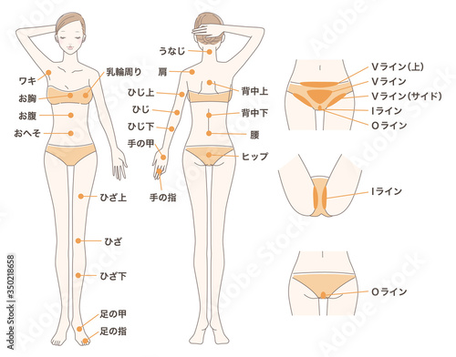 女性 脱毛 全身