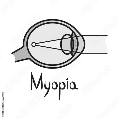 Isolated object of myopia and eye symbol. Graphic of myopia and cornea vector icon for stock.