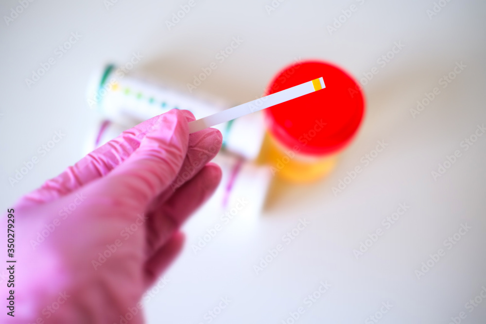 Medical exam, Urine test strip looking for infections and bacteria. Pee