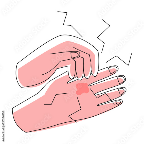Vector flat illustration with isolated hands where one scratches other. Concept dermatological diseases, allergies, scabies, eczema. It can be used in banners, web design, posters, etc.
