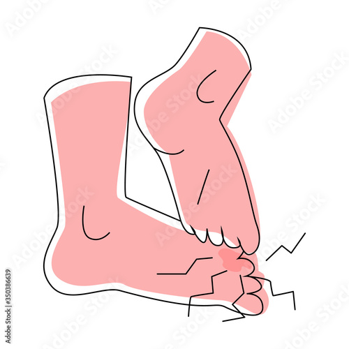 Vector flat illustration isolated legs where one is scratching other. Concept dermatological, fungal diseases of skin feet, dermatitis. It can be used in web design, banners, posters, etc.