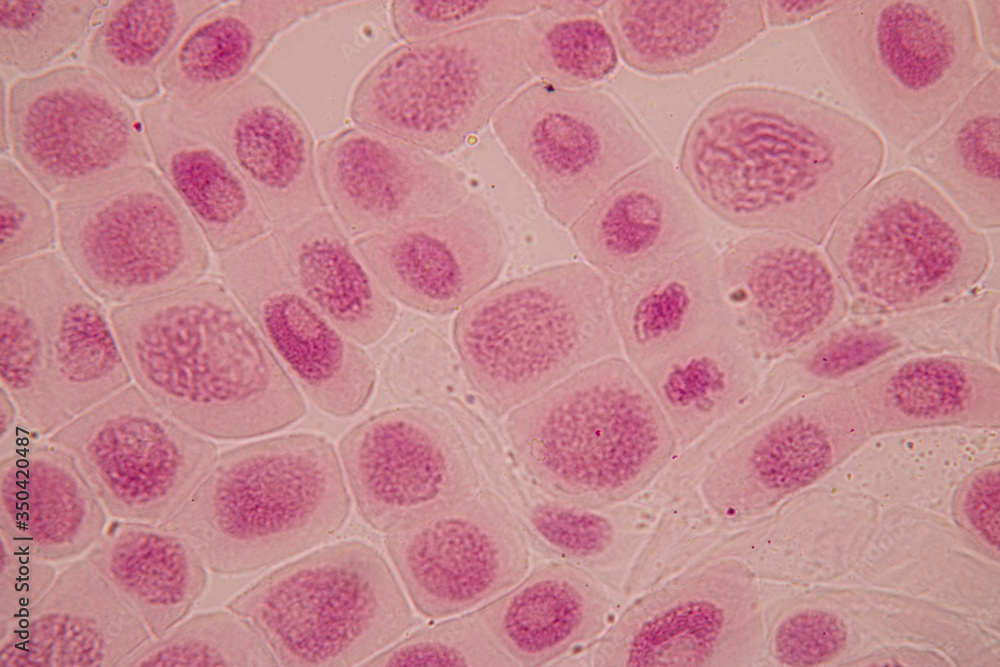 Root tip of Onion and Mitosis cell in the Root tip of Onion under a microscope.
Root tip of Onion and Mitosis cell in the Root tip of Onion under a microscope.