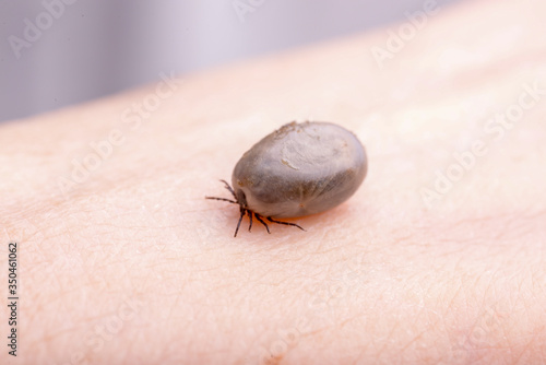 фотографія tick drunk blood on the skin