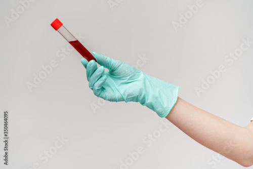 hand in latex glove holding blood in test tube close up