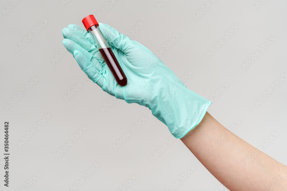 hand in latex glove holding blood in test tube close up hand in latex glove holding blood in test tube close up