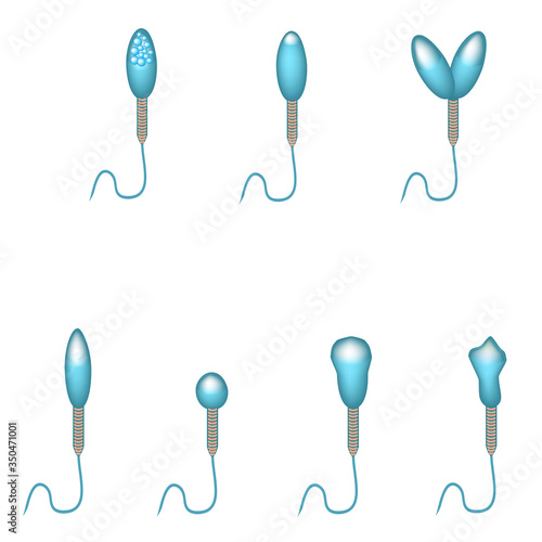 Pathological forms of sperm in the ejaculate. Male infertility Oligospermia. Spermogram. Pathology of the head. Sperm defects. Infographics. Vector illustration on isolated background.