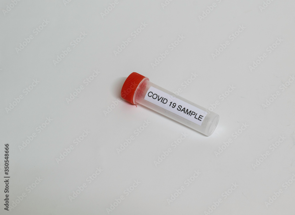 Test tube with sample for SARS-CoV-2 or COVID-19 virus test Test tube with sample for SARS-CoV-2 or COVID-19 virus test