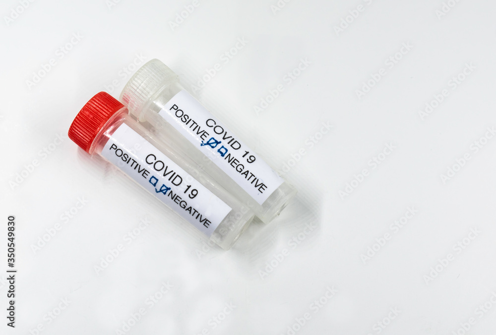 Testing for presence of coronavirus. Tube containing a swab sample that has tested positive for COVID-19. Testing for presence of coronavirus. Tube containing a swab sample that has tested positive for COVID-19.