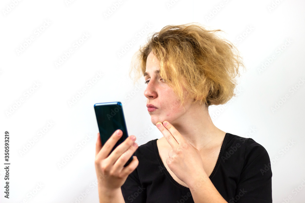 A girl with yellow hair talks on a video link on a smartphone, and examines the pimples on her face, a thoughtful expression on her face, against a white background. A girl with yellow hair talks on a video link on a smartphone, and examines the pimples on her face, a thoughtful expression on her face, against a white background.
