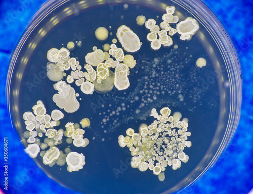 Tests for skin fungal diseases. Samples of fungus causing skin diseases grown in a petri dish