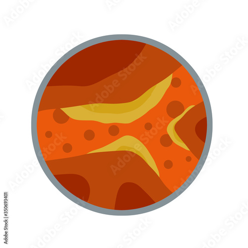 Cholesterol in vein and arteries. Heart and organ disease. Blockage and obstruction of canal. Magnified view under microscope. Health problem. Flat medical education