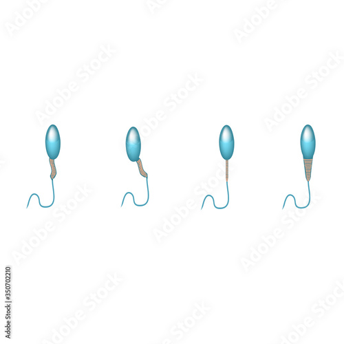 Pathological forms of sperm in the ejaculate. Male infertility Oligospermia. Spermogram. Pathology of the head. Sperm defects. Infographics. Vector illustration on isolated background.