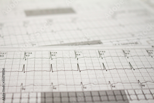 Wallpaper Mural Three-channel Holter EKG strip showing heartbeat waves. Electrical activity of the heart recorded on paper. Torontodigital.ca