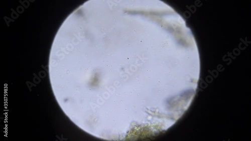 Microscopic larva at 100x magnification