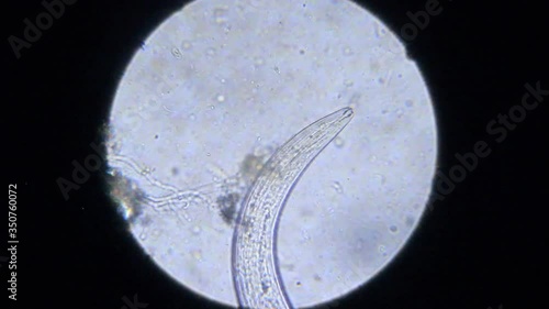Xiphinema at 100x magnification
