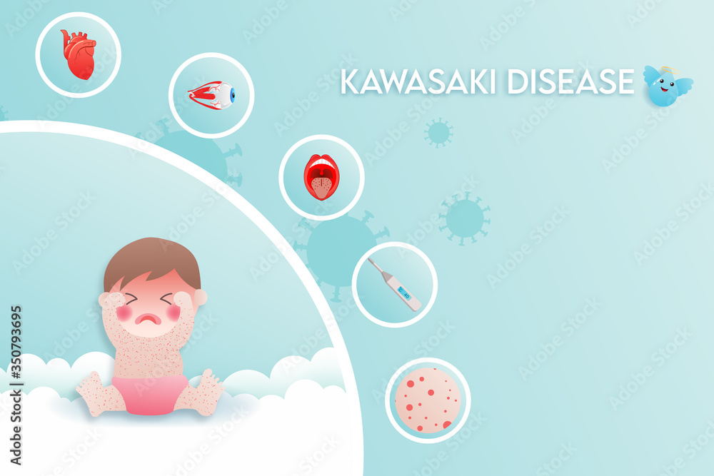 The boy has kawasaki disease, medical infographic. The boy has kawasaki disease, medical infographic.