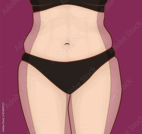 What hides the extra weight. The body of a woman before and after weight loss. Press and hips.