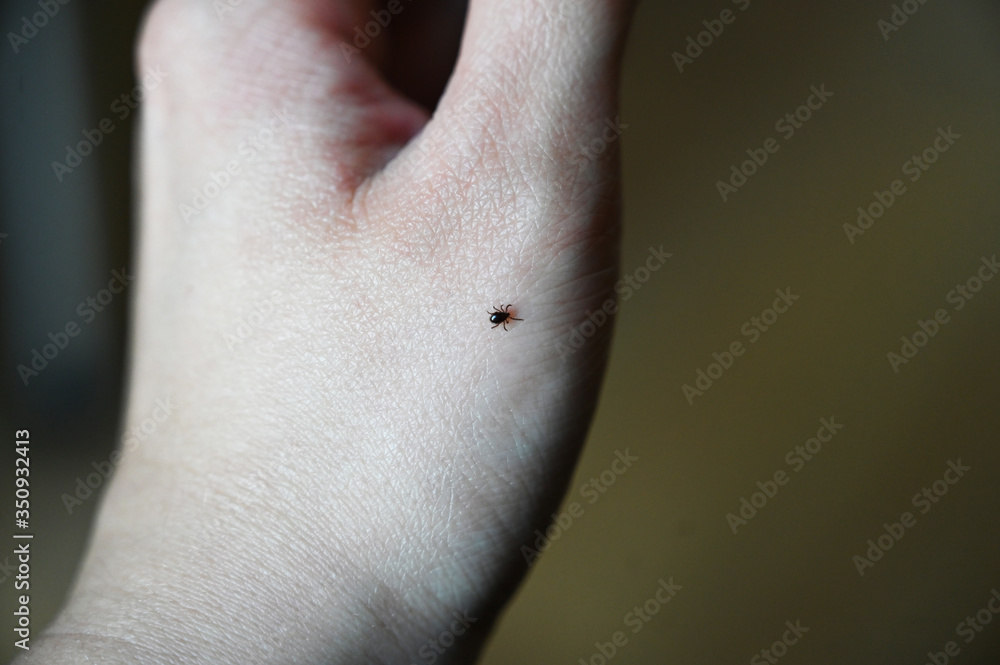 Fototapeta premium close up of a tick on hand