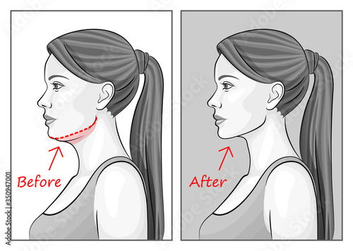 Female face before and after sports. Red outline showing overweight.