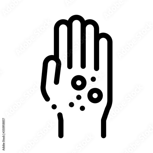 dermatitis rash on hands icon vector. dermatitis rash on hands sign. isolated contour symbol illustration