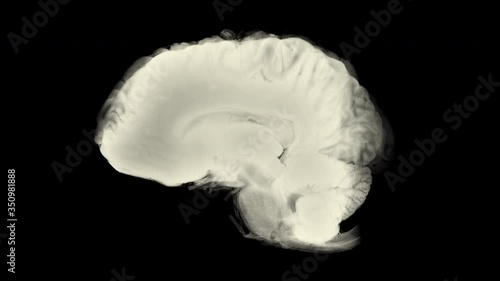 Side View Brain With Alpha Matte. Neurological Diseases, Tumors And Brain Surgery
