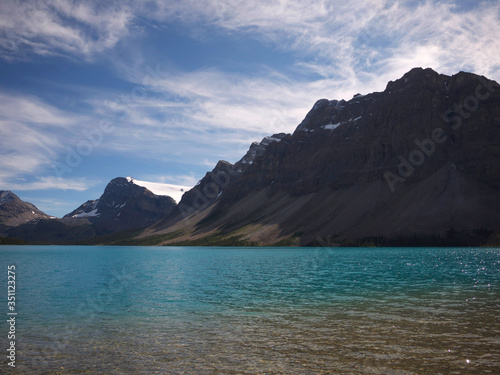 Turquoise Louise Lake in Rockies Mountains  Banff National Park  Alberta  Canada