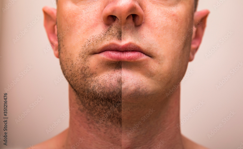 Closeup of man with beard on half of the face on grey background. Portrait of a handsome man with a shaved half his face. Closeup of man with beard on half of the face on grey background. Portrait of a handsome man with a shaved half his face.