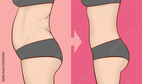 The body of a woman before and after losing weight. Belly view from side.