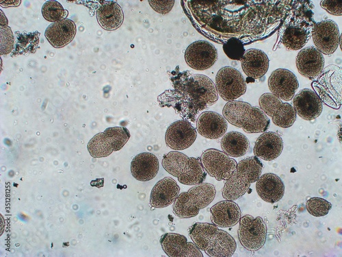Protoscolices Echinococcus multilocularis microscopic photo of being released from a larvacyst. Is a cyclophyllid tapeworm, produces the fatal disease alveolar echinococcosis in mammals
