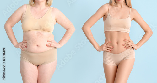 Woman before and after weig...