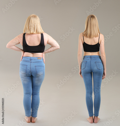 Woman before and after weig...