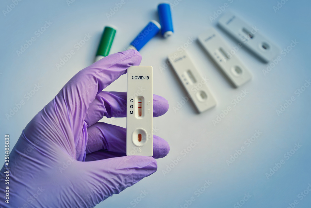 Foto de Disposable COVID19 test kit for rapid detection of antibodies