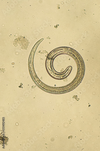 Trichinella spiralis - parasitic nematoda worm microscope