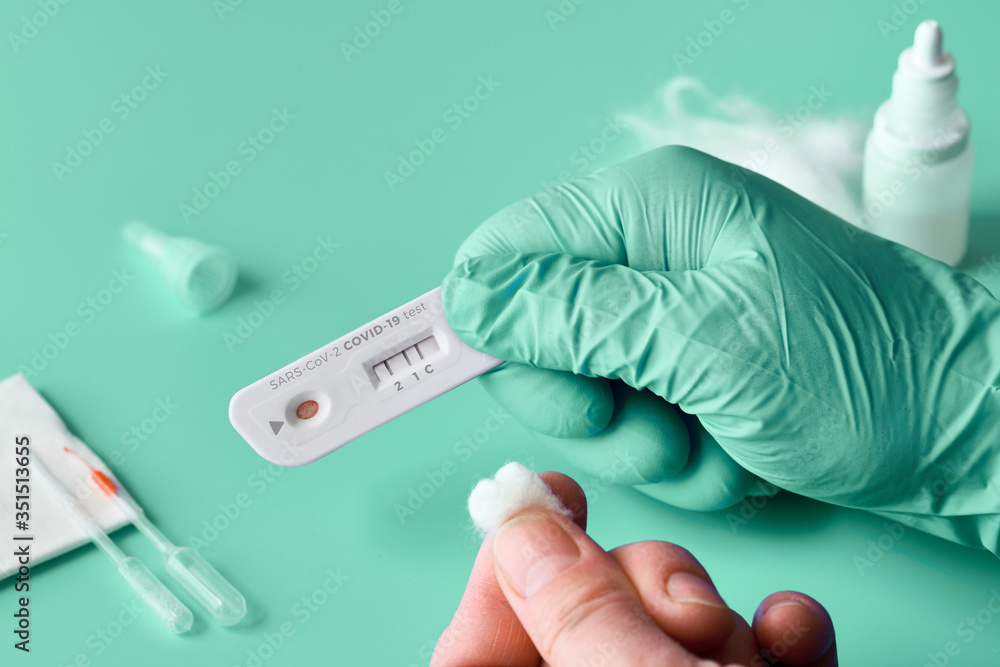 Express COVID-19 test for IgM and IgG antibodies to novel coronavirus SARS-CoV-2, Covid-19. Nurse hand in glove with positive coronavirus test. Patient fingers in front, green mint background. Express COVID-19 test for IgM and IgG antibodies to novel coronavirus SARS-CoV-2, Covid-19. Nurse hand in glove with positive coronavirus test. Patient fingers in front, green mint background.
