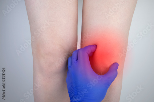 A woman suffers from knee pain. Examination by an orthopedist and traumatologist. Redness and swelling of the legs, torn meniscus or knee bursitis