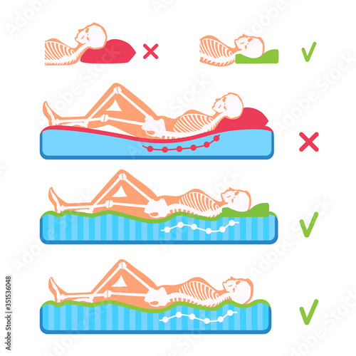 A woman lying on her back on the orthopedic mattress, side view. Silhouette with a skeleton. Comparison of a good, bad position, posture. A human spine, head support. Healthy and unhealthy sleeping.