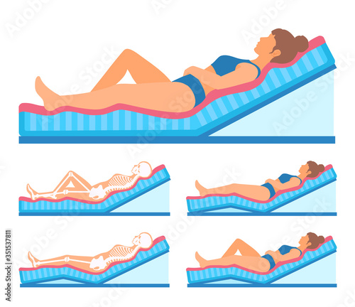A woman lies half-sitting, resting, sleeping comfortably. An orthopedic mattress is raised at an angle of 30 degrees. Distributed body weight. Bendable, adjustable bed recliner base.
