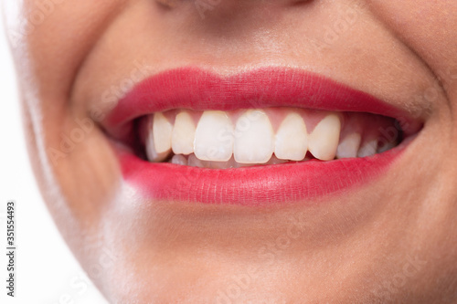 Close up of a smile with white teeth
