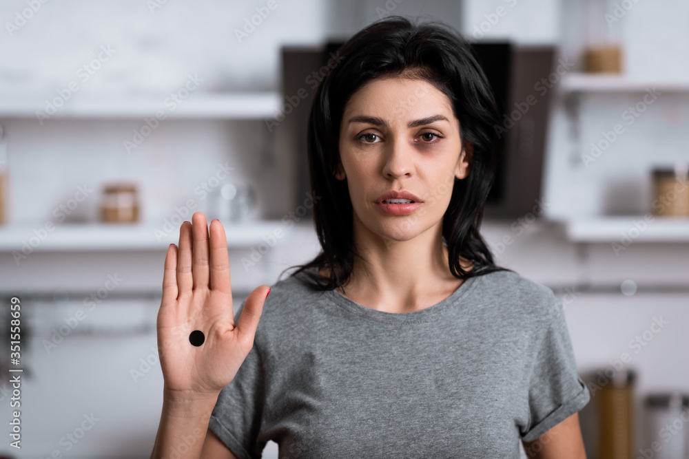 upset woman with bruise on face and black dot on palm, domestic violence  concept Stock-Foto | Adobe Stock
