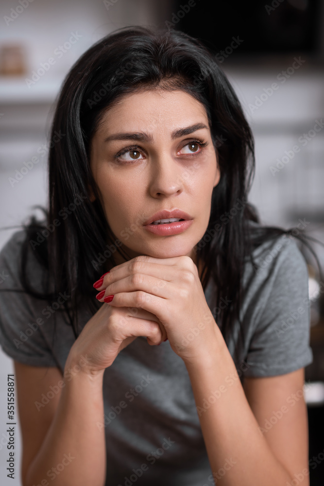 upset woman with bruise on face looking up, domestic violence concept upset woman with bruise on face looking up, domestic violence concept
