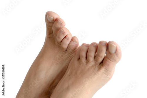 Feet of a caucasian adult woman on white background.