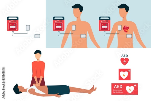Set of automated external defibrillator, AED and cardiopulmonary resuscitation.