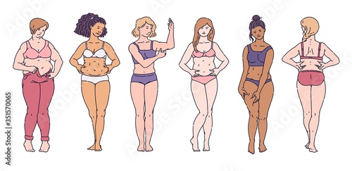 Set of women standing in underwear clamping fat folds on bodies cartoon style