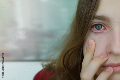A sick girl with an allergy opens her ears wide, wondering which allergen provoked her allergic reaction. Copyspace.