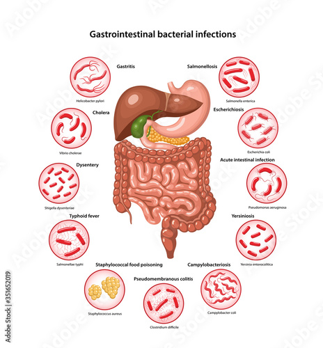 Page template with image of digestive system and bacteria that cause main gastrointestinal bacterial infections: Gastritis, Cholera, Dysentery, Salmonella, colitis. Vector illustration in flat style