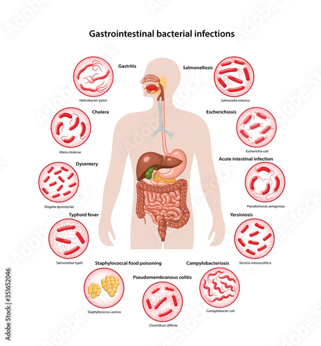 Page template with image of human body and bacteria that cause the main gastrointestinal bacterial infections: Gastritis, Cholera, Dysentery, Salmonella, colitis. Vector illustration in flat style