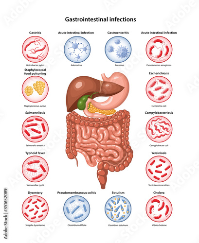 Page template with image of digestive system, bacteria and viruses that cause main gastrointestinal infections: Gastritis, Cholera, Dysentery, Salmonella, Gastroenteritis, colitis. Vector illustration photo