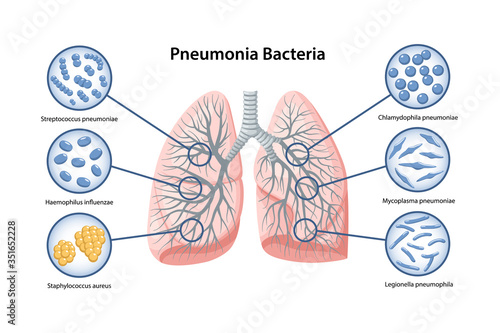 Page template with image of human lungs and Pneumonia bacteria in magnifying glass. Microbiology. Medical vector illustration in flat style in flat style over white background