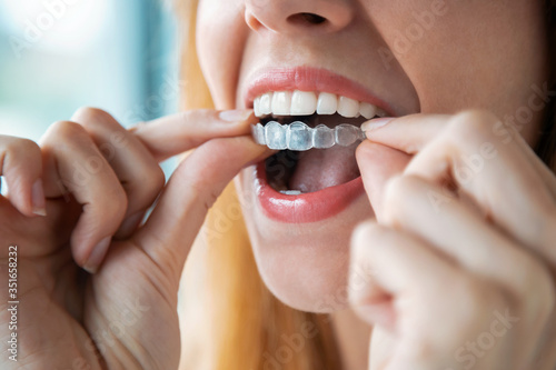 Woman wearing orthodontic silicone trainer. Invisible braces aligner. photo